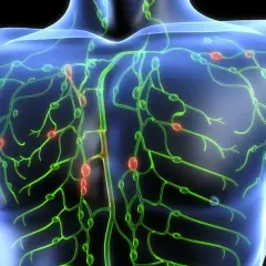 Das Lymphsystem des menschlichen Oberkörpers mit hervorgehobenen Lymphknoten. Dies kann helfen zu verstehen, was ein Lymphom ist.