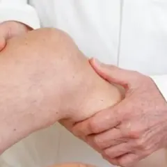 Arzt untersucht Knie. Mögliche Sarkom Symptome wie Schwellungen oder Schmerzen werden abgeklärt.