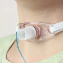 Trachealkanüle im Halsbereich, oft Teil der kehlkopfkrebs behandlung. Ein blauer Draht ist sichtbar.