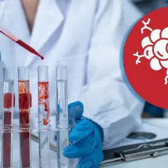 Laborant mit blauen Handschuhen tropft Blut in Reagenzgläser. Symbol für Tumormarker im Blut.