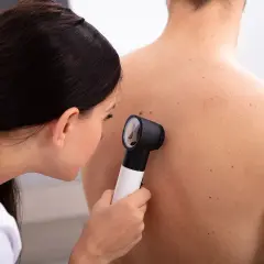 Ärztin untersucht Muttermale am Rücken eines Patienten. Hautkrebs ist nicht ansteckend.