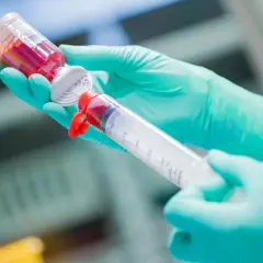 Hände in grünen Handschuhen ziehen rote Flüssigkeit aus einer Ampulle in eine große Spritze. Eine Chemotherapie-Spritze wird vorbereitet.