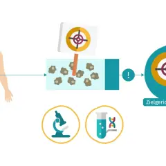 Illustration zeigt die Behandlung eines niedrig malignen Lymphoms mit zielgerichteter Therapie. Eine Spritze zielt auf Krebszellen.