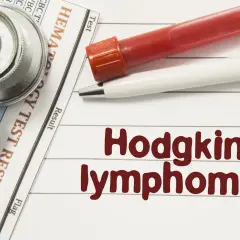 Stethoskop, Blutprobe und Stift liegen auf einem Laborbericht. Text: "Hodgkin lymphoma". Hier finden Sie Erfahrungsberichte zur Immuntherapie.