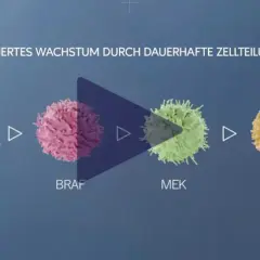 Zellteilungssignale treiben unkontrolliertes Wachstum bei Hautkrebs an. Immuntherapie kann hier ansetzen.