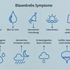 Grafik zeigt Symptome von Blasenkrebs: schmerzhaftes Urinieren, Blut im Urin, Harndrang, Inkontinenz, Rückenschmerzen, häufiges Urinieren, nächtliches Urinieren, Schwierigkeiten beim Urinieren, Gefühl der unvollständigen Blasenentleerung. Ein blasen tu...