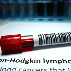 Blutprobe mit Barcode für Non-Hodgkin-Lymphom-Forschung. Neue Therapieansätze werden erforscht.