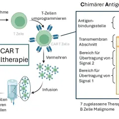 Schema der CAR T-Zelltherapie: T-Zellen werden entnommen, umprogrammiert und vermehrt, bevor sie als Infusion Krebszellen attackieren. Der chimäre Antigenrezeptor wird detailliert dargestellt.