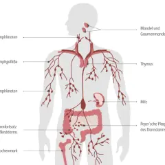 Das Lymphsystem mit Lymphknoten, Mandeln, Thymus, Milz und Darm. Mögliche Ursachen für Lymphom sind komplex und betreffen oft diese Organe.
