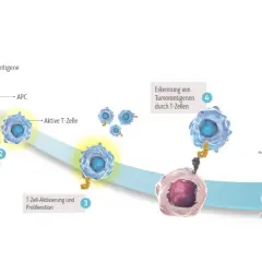 Schema der Immuntherapie: T-Zellen erkennen und zerstören Tumorzellen. Medikamenten-Namen sind hier nicht aufgeführt, aber der Prozess wird erklärt.