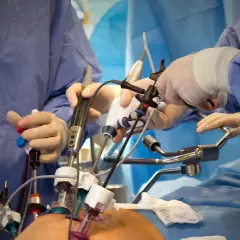Chirurgen führen eine minimalinvasive Prostata-OP durch. Hände in Handschuhen bedienen feine Instrumente, die durch kleine Schnitte eingeführt werden.