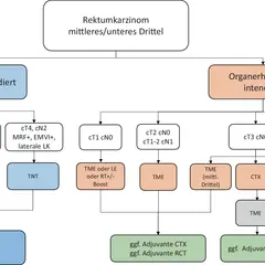 Flussdiagramm zur Behandlung von Rektumkarzinomen. Zeigt Entscheidungen basierend auf Tumorstadium, ob Organerhalt möglich ist, und ob die mesorektale Faszie betroffen ist.