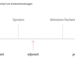 Zeitstrahl zeigt Behandlungsphasen bei Krebs: Diagnose, Operation, Metastasennachweis. Pfeile markieren neoadjuvante, adjuvante und palliative Therapie.