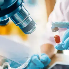 Forscher untersuchen Blutproben für die Immuntherapie bei Lungenkrebs. Ein Mikroskop und eine Ampulle mit roter Flüssigkeit sind zu sehen.
