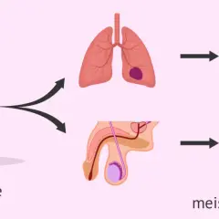 Chemotherapie kann die Fruchtbarkeit nach Chemotherapie Mann beeinträchtigen. Die Grafik zeigt Lungen- und Hodenkrebszellen, die durch die Behandlung angegriffen werden.