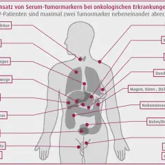 Schema zeigt Tumormarker wie CEA für verschiedene Organe, z.B. Lunge, Pankreas, Kolon/Rektum, zur Diagnose onkologischer Erkrankungen.
