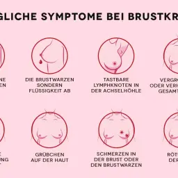 Grafik zeigt mögliche Symptome von Brustkrebs, darunter tastbare Lymphknoten in der Achselhöhle und eine Vergrößerung oder Verhärtung der Brust.