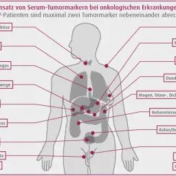 Schema zeigt Tumormarker wie CEA für verschiedene Organe, z.B. Lunge, Pankreas, Kolon/Rektum, zur Diagnose onkologischer Erkrankungen.