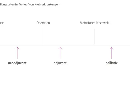 Zeitstrahl zeigt Behandlungsphasen bei Krebs: Diagnose, Operation, Metastasennachweis. Pfeile markieren neoadjuvante, adjuvante und palliative Therapie.