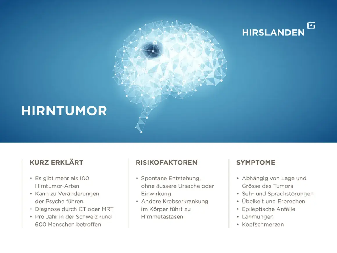 Abstrakte Darstellung eines Gehirns mit dem Titel "Hirntumor". Informationen über Symptome und Risikofaktoren eines Hirntumors echt.
