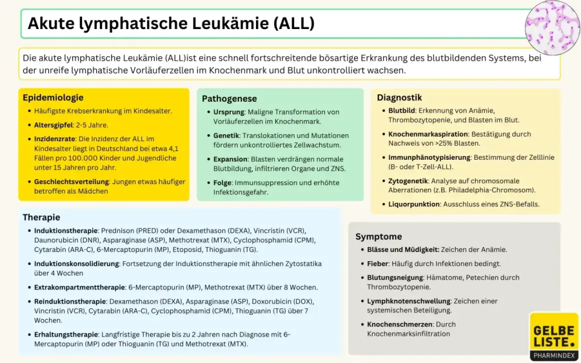 Infografik über akute lymphatische Leukämie (ALL), eine aggressive Krebserkrankung. Beschreibt Epidemiologie, Pathogenese, Diagnostik, Therapie und Symptome. Leukämie Stadium 4 ist hier nicht explizit erwähnt, aber die aggressive Natur der Krankheit wi...