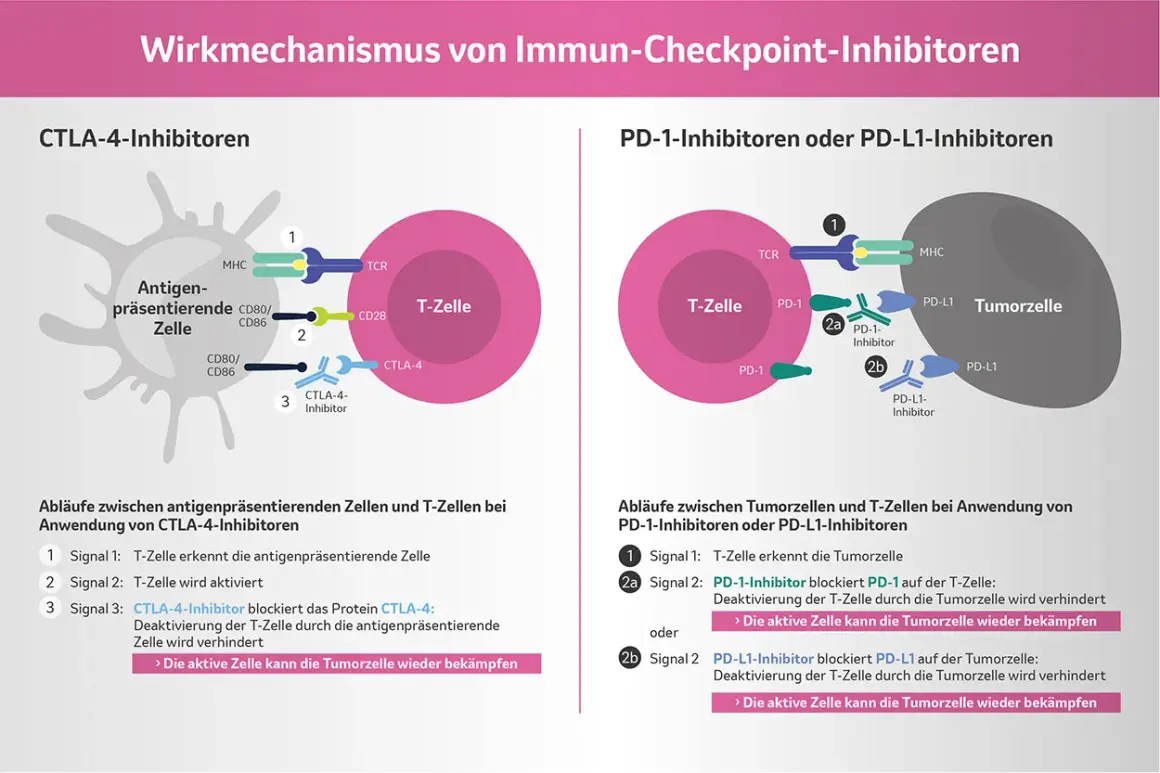Schema zeigt, wie PD-L1 Immuntherapie T-Zellen aktiviert, um Tumorzellen zu bekämpfen.