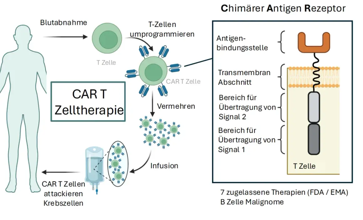 Schema der CAR T-Zelltherapie: T-Zellen werden entnommen, umprogrammiert und vermehrt, bevor sie als Infusion Krebszellen attackieren. Der chimäre Antigenrezeptor wird detailliert dargestellt.