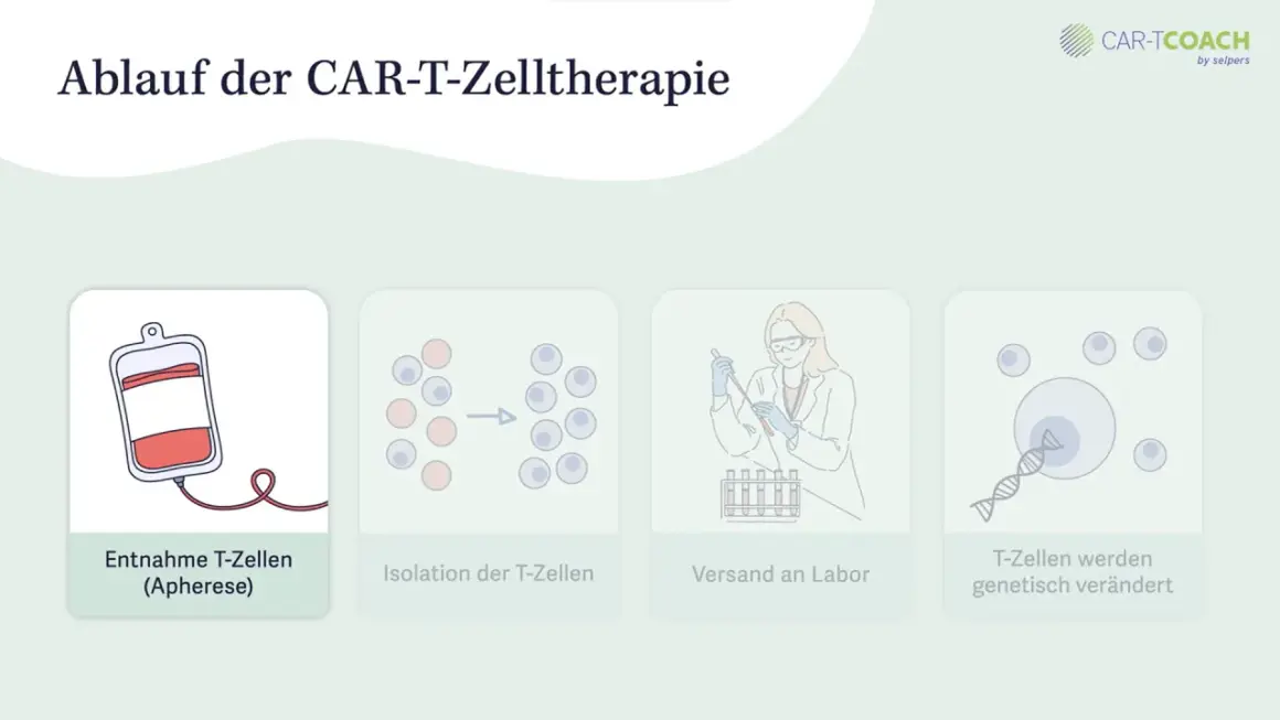 CAR-T-Zelltherapie voraussetzungen: Entnahme, Isolation, Versand ins Labor und genetische Veränderung von T-Zellen.