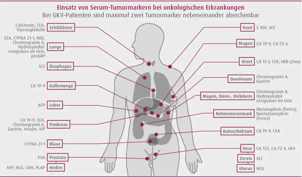 Schema zeigt Tumormarker wie CEA für verschiedene Organe, z.B. Lunge, Pankreas, Kolon/Rektum, zur Diagnose onkologischer Erkrankungen.