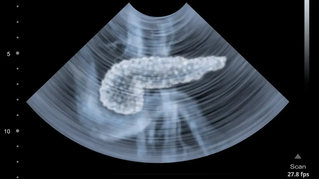 Ultraschallbild einer Bauchspeicheldrüse. Die Pankreas Untersuchung zeigt das Organ in detaillierter Ansicht.