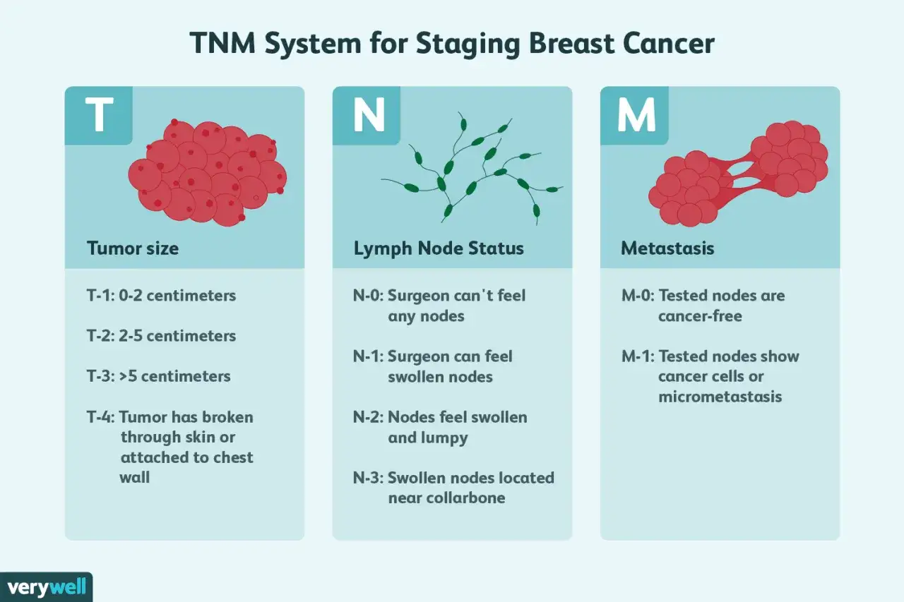 Das TNM-System zur Bestimmung von Mammakarzinom Stadien: Tumorgröße (T), Lymphknotenstatus (N) und Metastasierung (M).