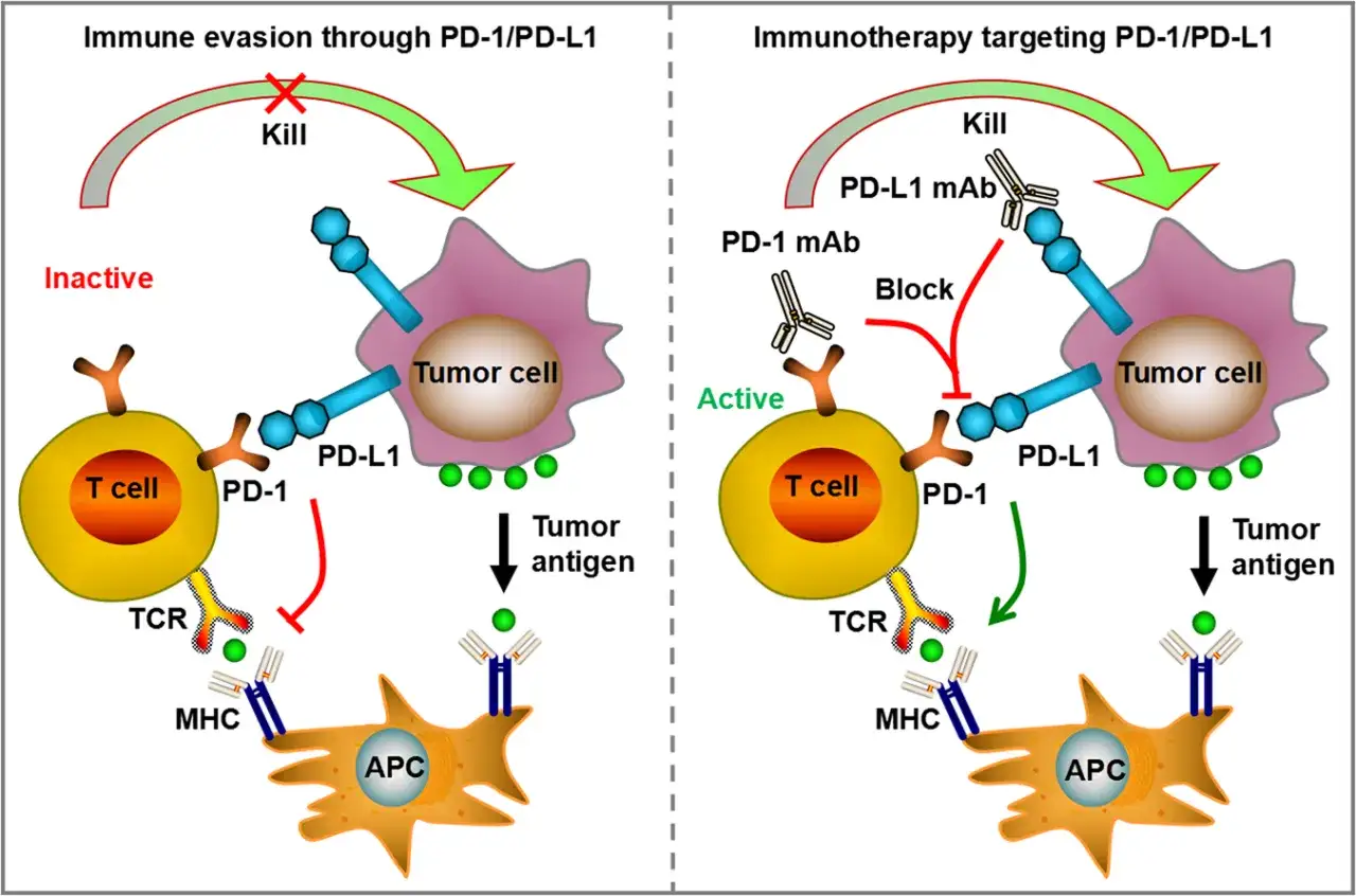 Schema zeigt Immuntherapie mit Medikamenten wie PD-1- und PD-L1-Antikörpern, die Tumorzellen bekämpfen.