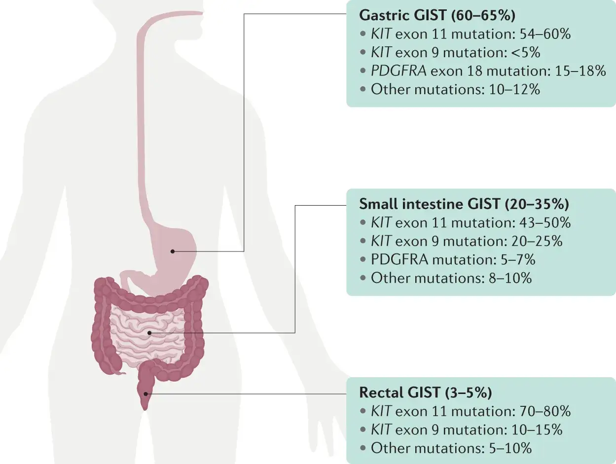 Schema des Verdauungstrakts mit Hervorhebung von Magen, Dünndarm und Rektum, verbunden mit Informationen zu GIST-Tumoren und deren genetischen Mutationen.