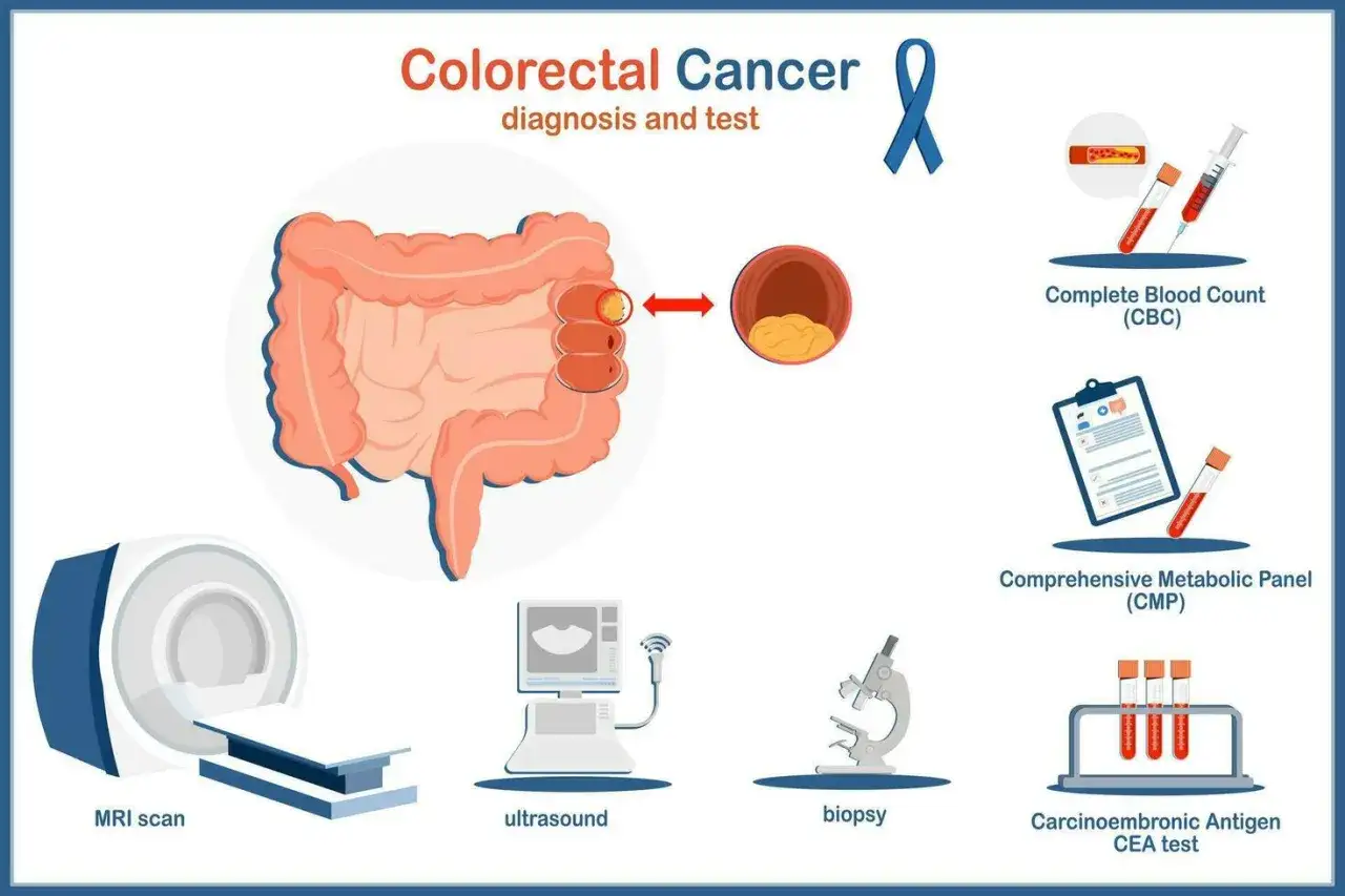 Illustration zeigt Darmkrebs im Enddarm und verschiedene Diagnosemethoden wie MRT, Ultraschall, Biopsie und Bluttests.
