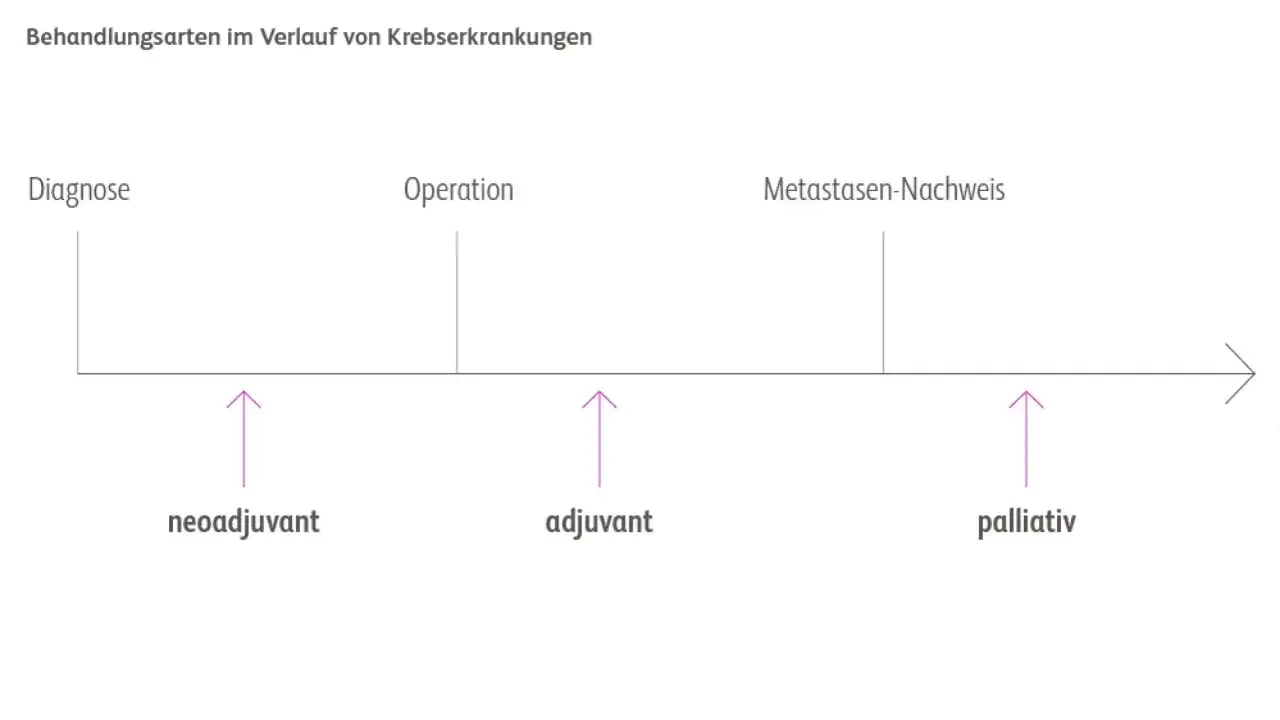 Zeitstrahl zeigt Behandlungsschritte bei Krebs: neoadjuvant vor OP, adjuvant nach OP, palliativ bei Metastasennachweis.