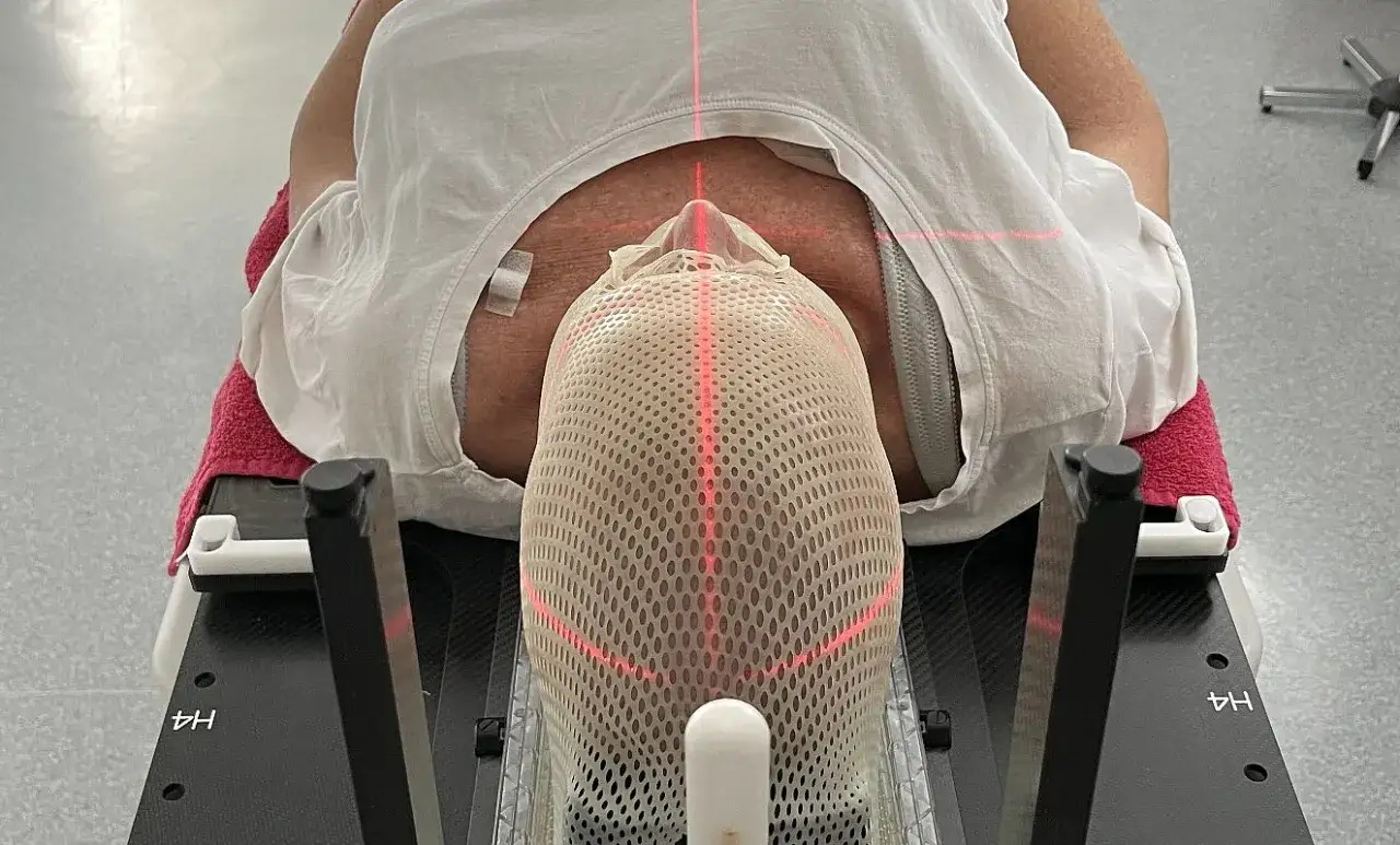 Person liegt auf Liege, Kopf fixiert mit Maske, rote Laserlinien für präzise Strahlentherapie Brustkrebs Erfahrungen.