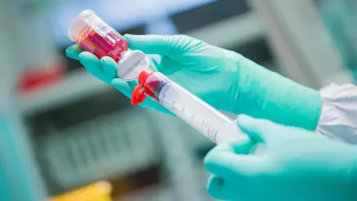 Chemo-Spritze - Was wirklich dahintersteckt & Warnsignale
