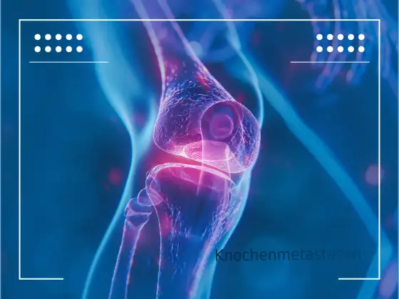 Knochenmetastasen - Symptome, Diagnose & Behandlung verstehen